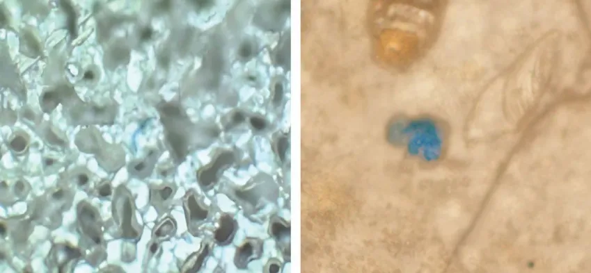 microplástico no cérebro